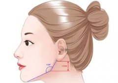 削骨手術(shù)后遺癥有哪些？多少錢?必看指南！